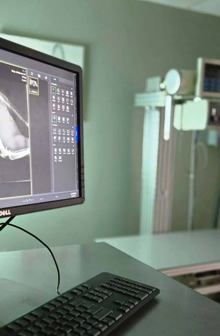Xray2 1